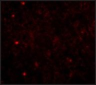 Anti-TOM70 antibody produced in rabbit affinity isolated antibody