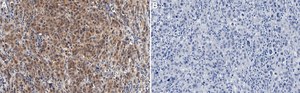 Anti-PTEN Antibody, clone 6H2.1 ZooMAb® Mouse Monoclonal recombinant, expressed in HEK 293 cells