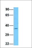 Anti-HYAL1 (ab2) antibody produced in rabbit affinity isolated antibody