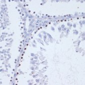 Anti-Phospho-γH2A.X-S139 antibody produced in rabbit