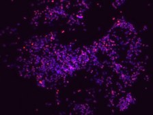 Porphyromonas gingivalis FISH probe - Cy3 Probe for fluorescence in situ hybridization (FISH),20 μM in water
