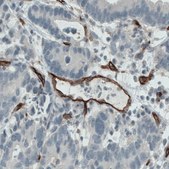 Monoclonal Anti-ENG antibody produced in mouse Prestige Antibodies® Powered by Atlas Antibodies, clone CL1912, purified immunoglobulin, buffered aqueous glycerol solution