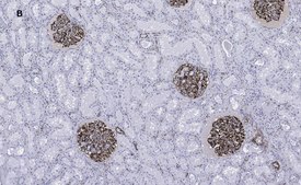 Anti-Nestin Antibody, clone 8B8, ZooMAb® Rabbit Monoclonal recombinant, expressed in HEK 293 cells