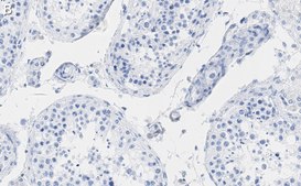 Anti-HSP90 alpha Antibody, clone 4M13 ZooMAb® Rabbit Monoclonal recombinant, expressed in HEK 293 cells