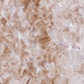 Anti-FPR1 antibody produced in rabbit Prestige Antibodies® Powered by Atlas Antibodies, affinity isolated antibody, buffered aqueous glycerol solution