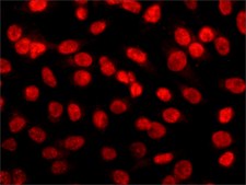 Anti-Histone Deacetylase 2 (HDAC2) antibody, Mouse monoclonal clone HDAC2-62, purified from hybridoma cell culture