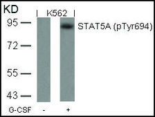 Anti-phospho-STAT5A (pTyr694) antibody produced in rabbit affinity isolated antibody