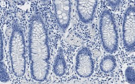 Anti-TOMM20 Antibody, clone 2F8.1 ZooMAb® Mouse Monoclonal recombinant, expressed in HEK 293 cells