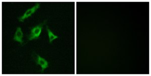 Anti-Stathmin 1 antibody produced in rabbit affinity isolated antibody