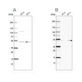 Anti-UQCRC1 antibody produced in rabbit Ab2, Prestige Antibodies® Powered by Atlas Antibodies, affinity isolated antibody, buffered aqueous glycerol solution