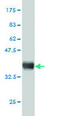 Monoclonal Anti-GLB1 antibody produced in mouse clone 6E7, purified immunoglobulin, buffered aqueous solution