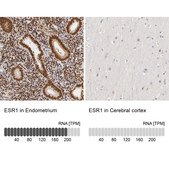 Anti-ESR1 antibody produced in rabbit Prestige Antibodies® Powered by Atlas Antibodies, affinity isolated antibody, buffered aqueous glycerol solution