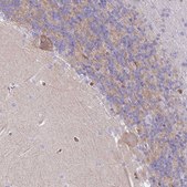 Anti-ANK1 antibody produced in rabbit Prestige Antibodies® Powered by Atlas Antibodies, affinity isolated antibody, buffered aqueous glycerol solution