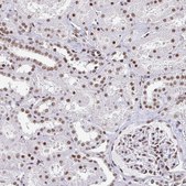 Monoclonal Anti-CTCF antibody produced in mouse Prestige Antibodies® Powered by Atlas Antibodies, clone CL0304, purified immunoglobulin, buffered aqueous glycerol solution