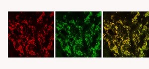 Anti-Vesicular Glutamate Transporter 2 Antibody clone 8G9.2, Chemicon®, from mouse
