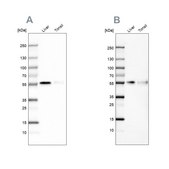 Anti-CD14 antibody produced in rabbit Ab3, Prestige Antibodies® Powered by Atlas Antibodies, affinity isolated antibody, buffered aqueous glycerol solution