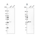 Anti-MS4A1 antibody produced in rabbit Prestige Antibodies® Powered by Atlas Antibodies, affinity isolated antibody, buffered aqueous glycerol solution