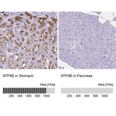 Anti-ATP4B antibody produced in rabbit Prestige Antibodies® Powered by Atlas Antibodies, affinity isolated antibody, buffered aqueous glycerol solution