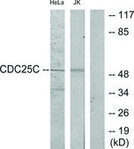 Anti-CDC25C antibody produced in rabbit affinity isolated antibody