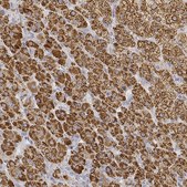 Anti-CYP11A1 antibody produced in rabbit Prestige Antibodies® Powered by Atlas Antibodies, affinity isolated antibody, buffered aqueous glycerol solution