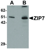 Anti-ZIP7 antibody produced in rabbit affinity isolated antibody