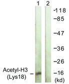 Anti-Histone H3 (Acetyl-Lys18) antibody produced in rabbit affinity isolated antibody