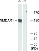 Anti-NMDAR1 antibody produced in rabbit affinity isolated antibody