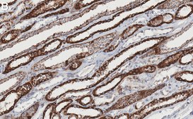 Anti-Aconitase 2/ACO2 Antibody, clone 1D15 ZooMAb® Rabbit Monoclonal recombinant, expressed in HEK 293 cells