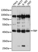 Anti-TBP antibody produced in rabbit