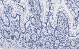 Anti-Brd4 Antibody, clone 1J17 ZooMAb® Rabbit Monoclonal recombinant, expressed in HEK 293 cells