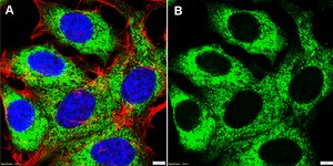Anti-RPS3 Antibody, clone 3I17 ZooMAb® Rabbit Monoclonal recombinant, expressed in HEK 293 cells