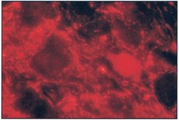 Anti-Choline Acetyltransferase Antibody serum, Chemicon®