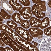 Anti-DDC antibody produced in rabbit Prestige Antibodies® Powered by Atlas Antibodies, affinity isolated antibody, buffered aqueous glycerol solution