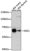 Anti-SGK1 antibody produced in rabbit