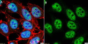 Anti-CDKL5 Antibody, clone 2J15 ZooMAb® Rabbit Monoclonal recombinant, expressed in HEK 293 cells