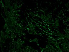 Monoclonal Anti-Neurofilament 160 antibody produced in mouse clone NN18, ascites fluid