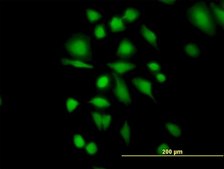 Anti-ETHE1 antibody produced in mouse IgG fraction of antiserum, buffered aqueous solution