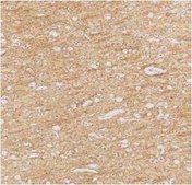 Anti-ATR Antibody from rabbit, purified by affinity chromatography