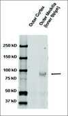 Anti-SCNN1B antibody produced in rabbit 1 mg/mL, affinity isolated antibody