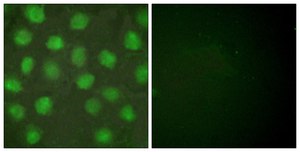 Anti-Retinoid X Receptor γ antibody produced in rabbit affinity isolated antibody