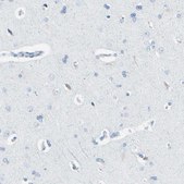 Anti-TPO antibody produced in rabbit Prestige Antibodies® Powered by Atlas Antibodies, affinity isolated antibody, buffered aqueous glycerol solution