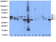 Anti-Cytokeratin AE1/AE3 Antibody, recognizes acidic &amp; basic cytokeratins, clone AE1/AE3 clone AE1/AE3, Chemicon®, from mouse