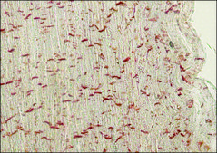 抗-泛钙粘蛋白单克隆抗体 小鼠抗 clone CH-19, ascites fluid