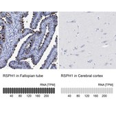 抗-RSPH1 兔抗 Prestige Antibodies® Powered by Atlas Antibodies, affinity isolated antibody, buffered aqueous glycerol solution
