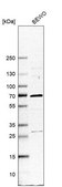 Anti-NR1H3 antibody produced in rabbit Prestige Antibodies® Powered by Atlas Antibodies, affinity isolated antibody, buffered aqueous glycerol solution