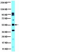 Anti-PP2A Antibody, B β subunit from rabbit, purified by affinity chromatography