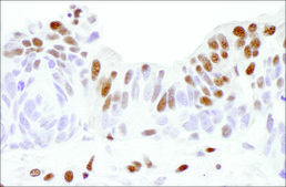 Goat anti-Sp1 Antibody, Affinity Purified Powered by Bethyl Laboratories, Inc.