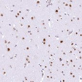 Anti-HNRNPA0 antibody produced in rabbit Prestige Antibodies® Powered by Atlas Antibodies, affinity isolated antibody, buffered aqueous glycerol solution