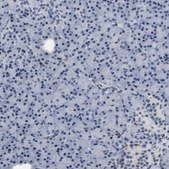 Anti-KCNC3 antibody produced in rabbit Prestige Antibodies® Powered by Atlas Antibodies, affinity isolated antibody, buffered aqueous glycerol solution