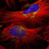 Anti-MRPL40 antibody produced in rabbit Prestige Antibodies® Powered by Atlas Antibodies, affinity isolated antibody, buffered aqueous glycerol solution